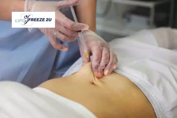 How Does Aqualyx Fat Dissolving Injection Work to Break Down Fat Romford?