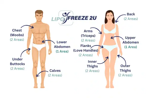 Areas you can have fat freezing treatment Romford
