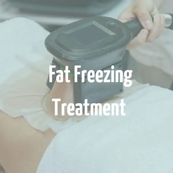 fat freezing treatment Romford