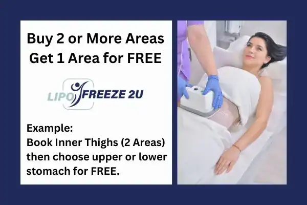 fat freezing prices Romford