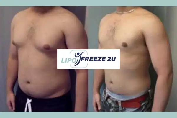 How Long Does It Take to See Results Romford?