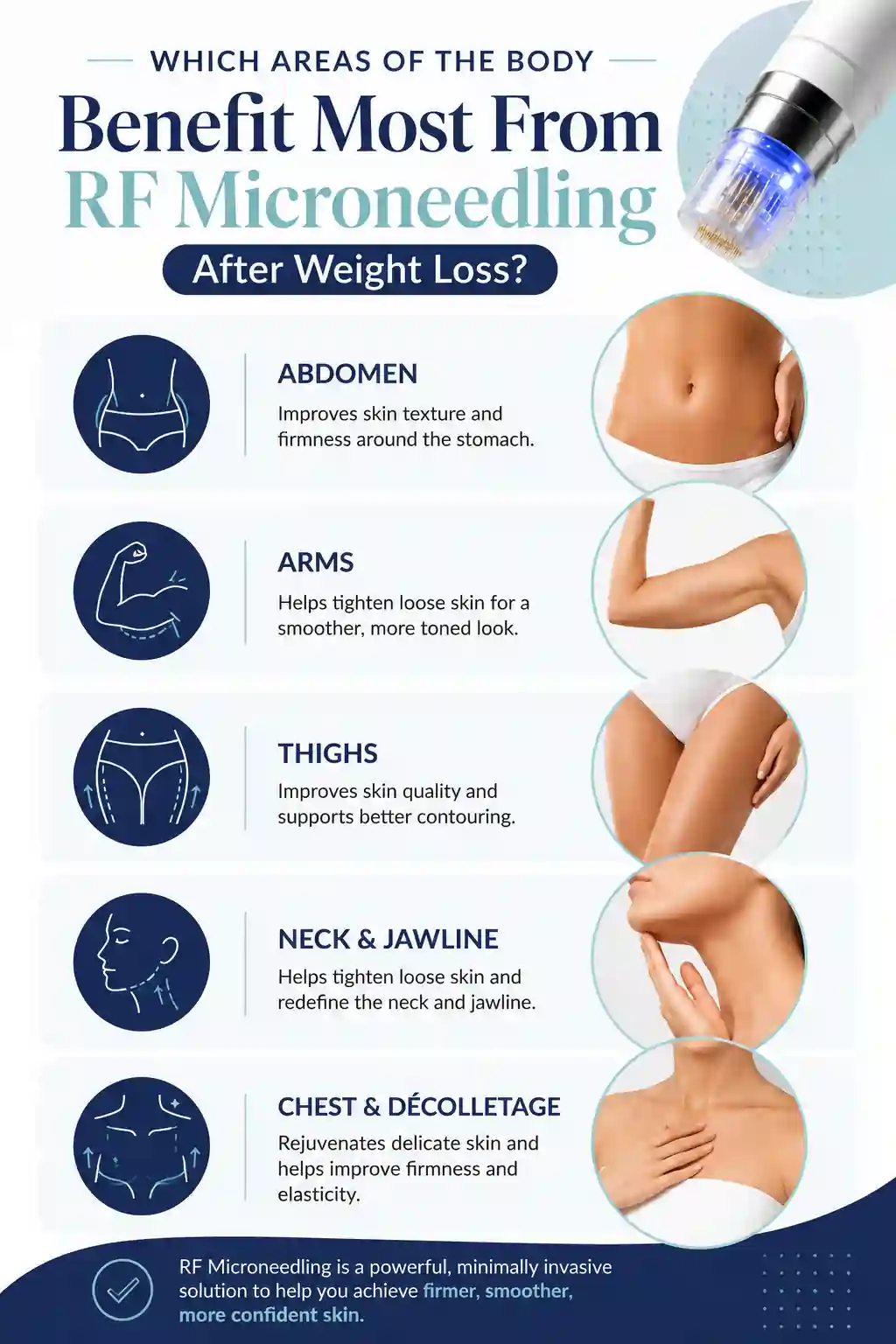 Which Areas of the Body Benefit Most From RF Microneedling After Weight Loss Romford